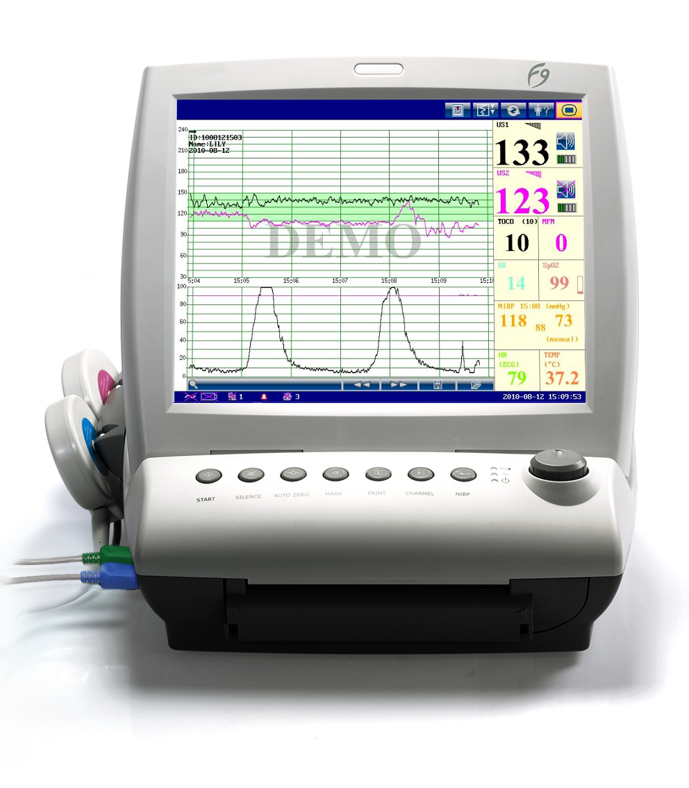 Фетальный монитор F9_69d38f471c735.jpeg Фетальный монитор F9 — изображение 3
