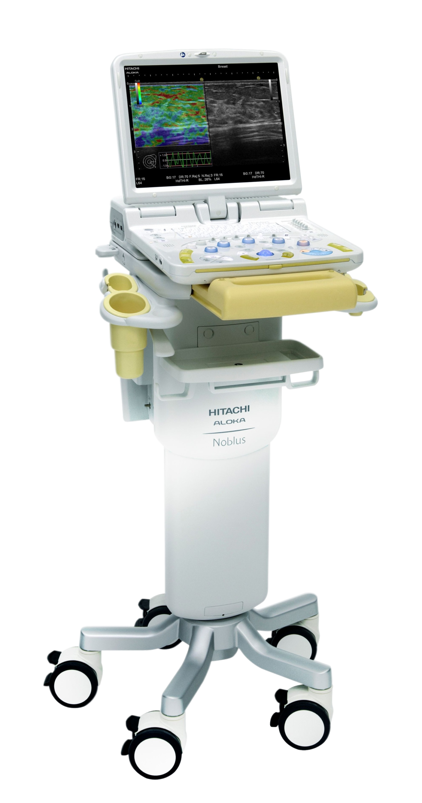 УЗИ аппарат Hitachi Noblus_69d3af038e7b3.png УЗИ аппарат Hitachi Noblus — изображение 1