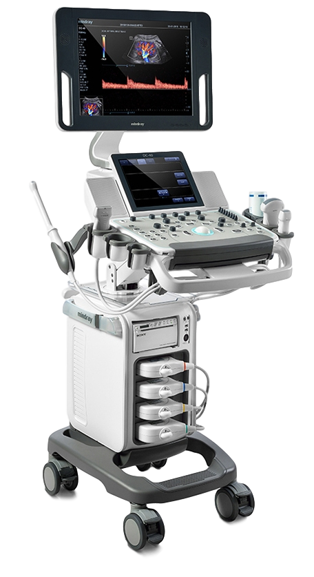 УЗИ аппарат Mindray DC-40_69dabe133a85f.png УЗИ аппарат Mindray DC-40 — изображение 1
