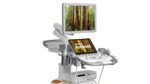 УЗИ аппарат Siemens Acuson Redwood — изображение 3