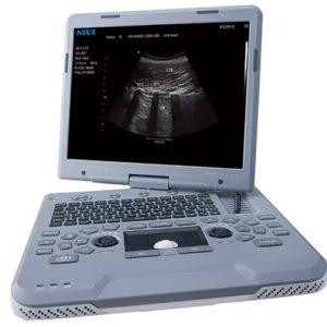 УЗИ аппарат Siui Apogee 1100 Neo