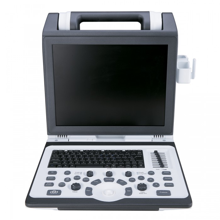 УЗИ аппарат SIUI CTS 7700_69d3af3dad82f.jpeg УЗИ аппарат SIUI CTS 7700 — изображение 1