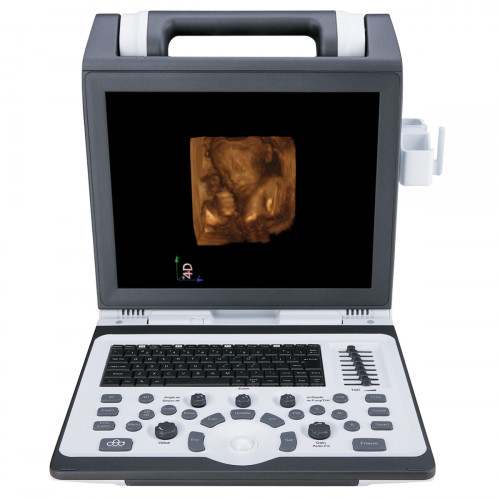 УЗИ аппарат SIUI CTS 7700_69d3af3e16e9a.jpeg УЗИ аппарат SIUI CTS 7700 — изображение 2