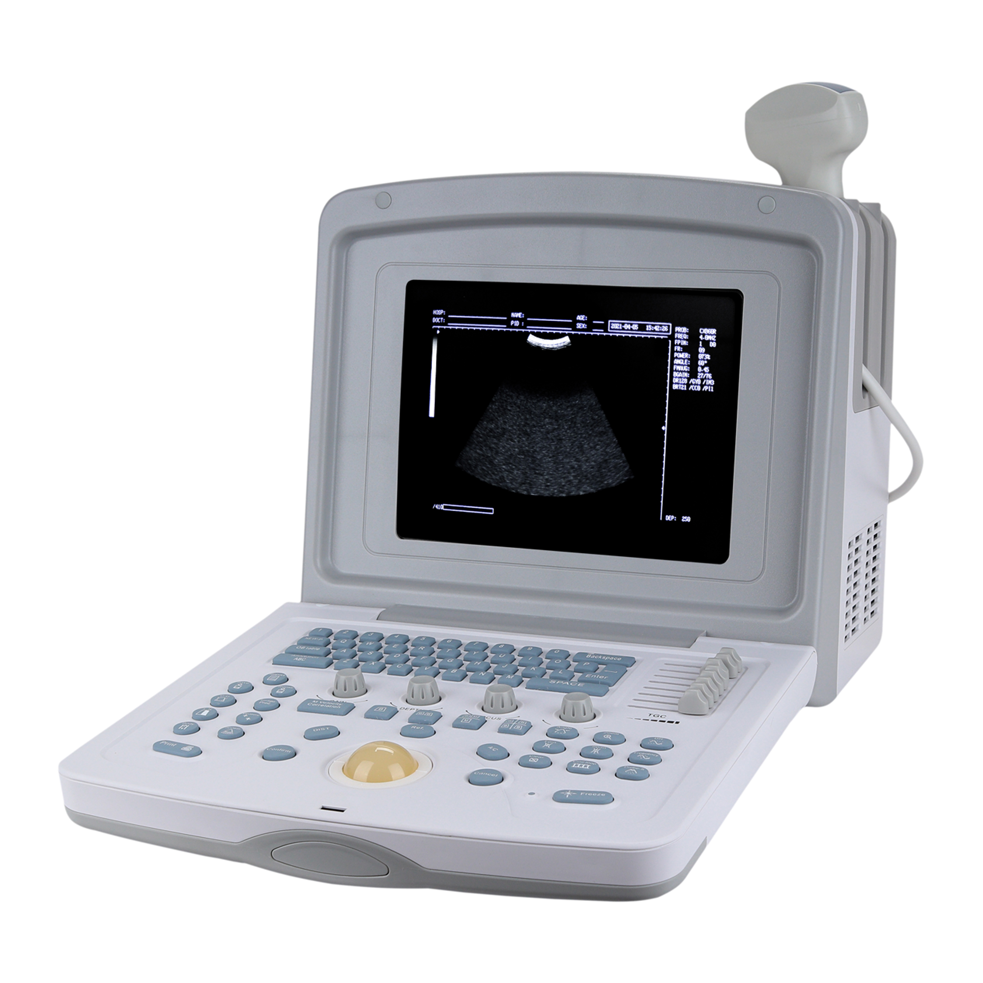 УЗИ сканер Med-Mos CMS600B3_69d3ae12b5825.jpeg УЗИ сканер Med-Mos CMS600B3 — изображение 1