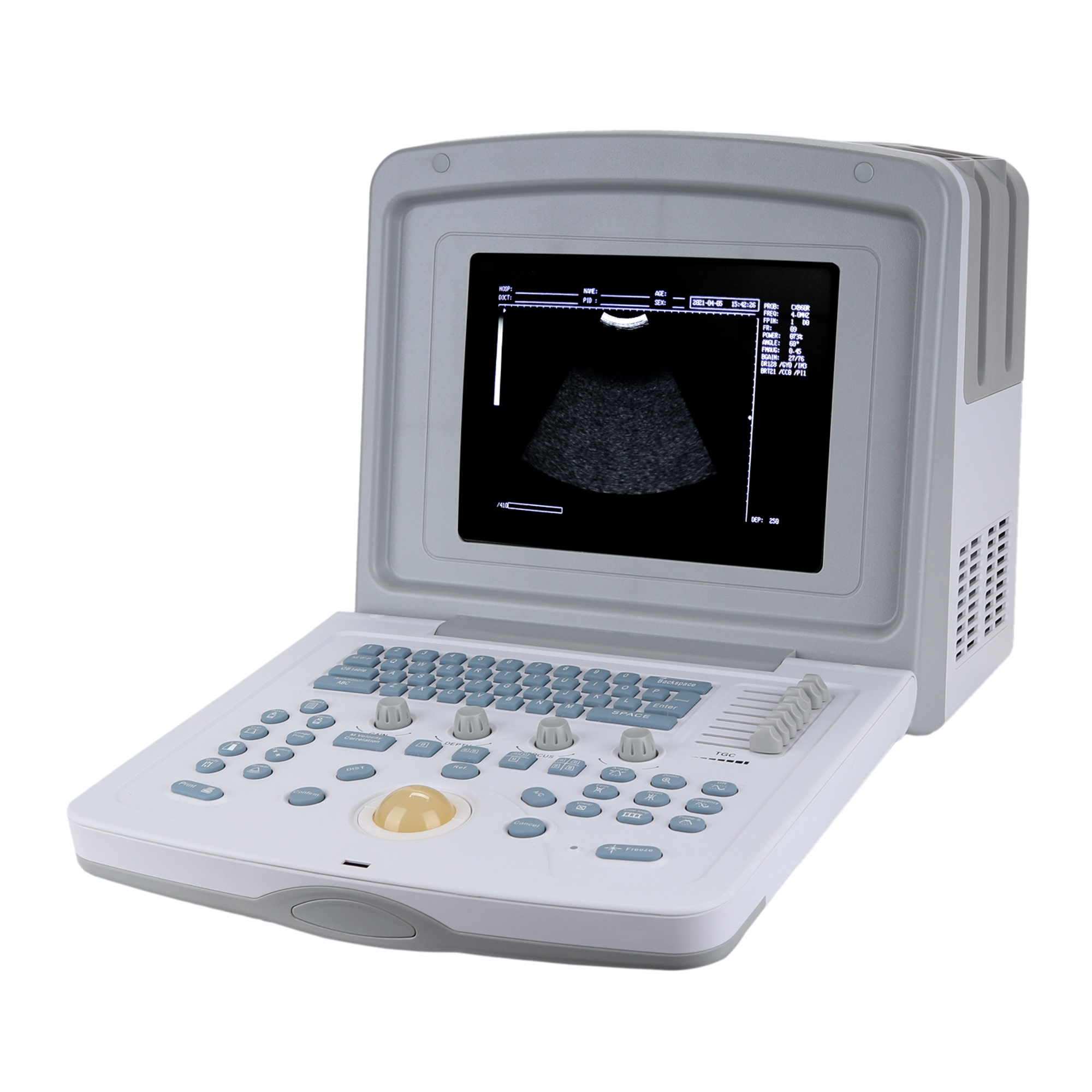 УЗИ сканер Med-Mos CMS600B3_69d3ae18a1779.jpeg УЗИ сканер Med-Mos CMS600B3 — изображение 2