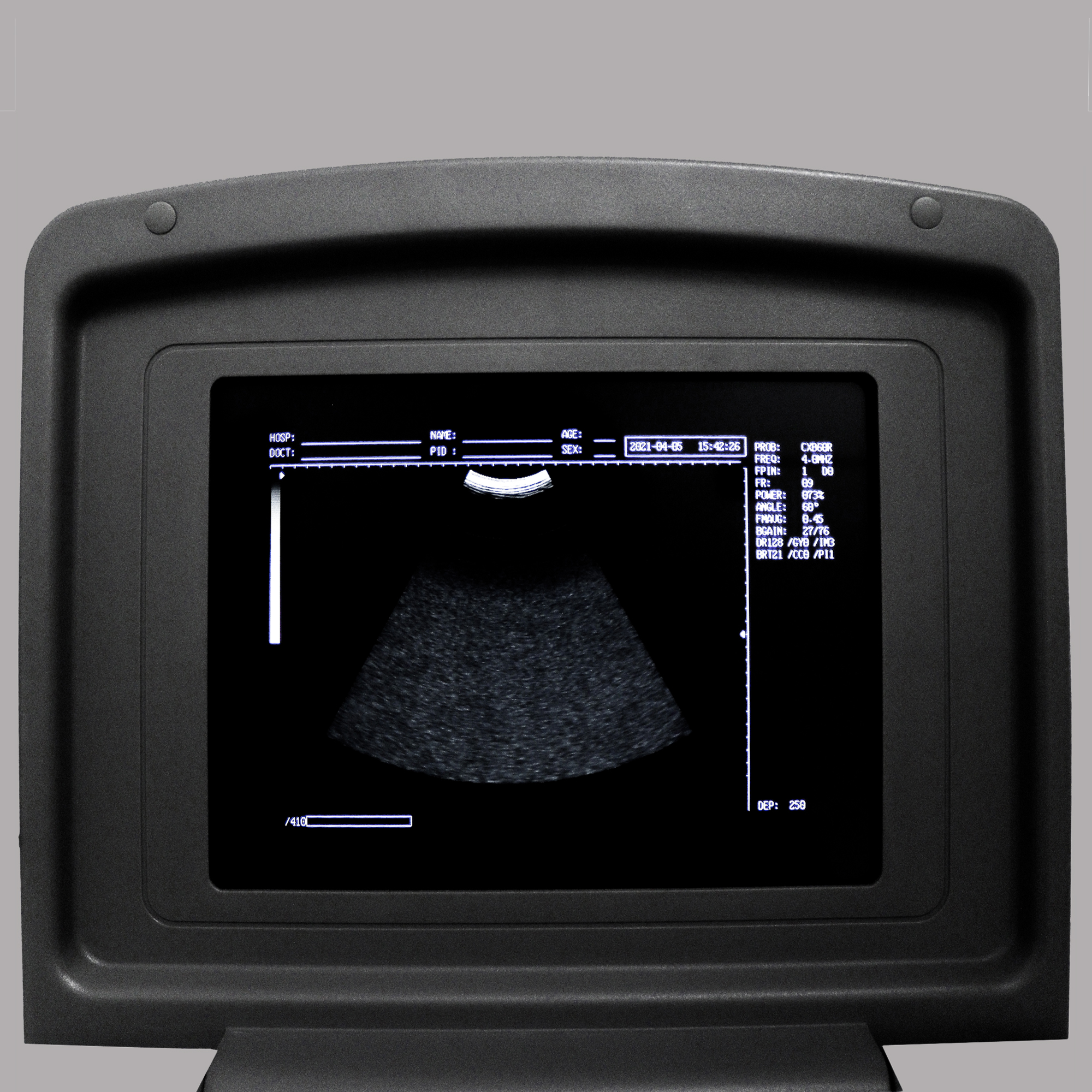 УЗИ сканер Med-Mos CMS600B3_69d3ae2c95163.jpeg УЗИ сканер Med-Mos CMS600B3 — изображение 13